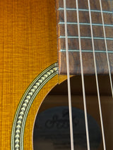 Close-up detail of an acoustic guitar showing the dark wood fretboard, silver strings, and the golden-yellow soundboard with a green and gold rosette inlay.
