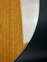 Close-up of a guitar's soundboard and bracing pattern with a dark background