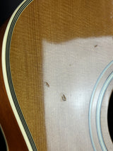 Close-up of a guitar's soundhole with visible wood grain and white pickguard.
