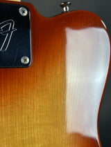 Close-up of a guitar's back with a brand logo on a dark background
