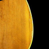 Wear on body of Vintage 1960 Martin 000-28.