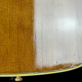 Wear on body of Vintage 1960 Martin 000-28.