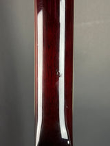 Wear on back of neck of Used LTD Viper-400 Natural.