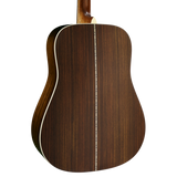 Back of body of Martin D-28 Sunburst.