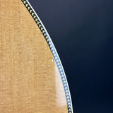 Ding on body of Used 2024 Martin OM-28.