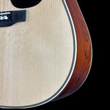 Close-up of an acoustic guitar body showing the natural wood top, sound hole, bridge, and the edge of the reddish-brown back against a black background.