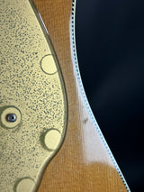 Wear near pickguard
